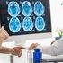 Sclerosi multipla, oggi la malattia si può controllare. Ma servono più assistenza e diritti