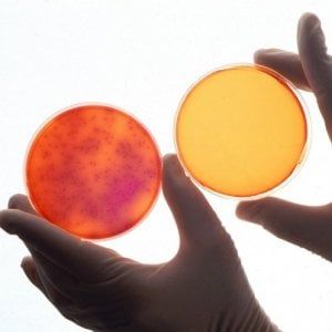 Contro la dermatite, una spremuta di batteri
