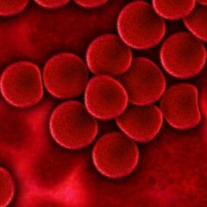 Mielodisplasie, quando è il sangue si impoverisce