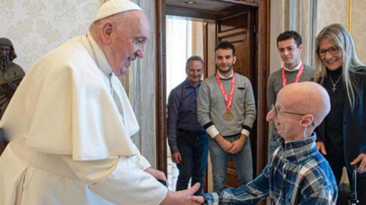Sammy Basso, cos’è la progeria, la malattia dei bimbi che invecchiano