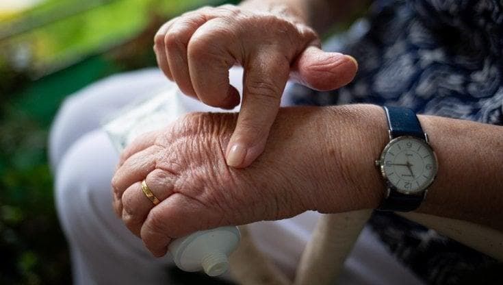 Artrite: 1 paziente su 3 non segue correttamente le terapie