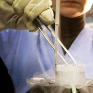 Fecondazione assistita, tutte in fila per l'egg freezing
