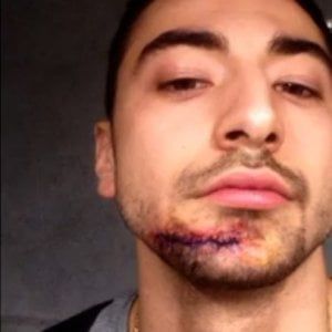 Studente pestato a sangue da gang di asiatici