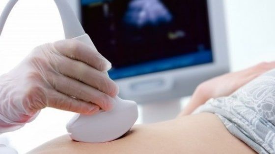 Tumore ovarico da 20 chili asportato a una donna che lamentava 'senso di gonfiore': intervento record nel Barese