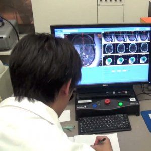 Tumori, "Per la prima volta creati 'varchi' per far penetrare farmaci chemioterapici nel cervello"