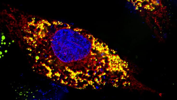 Le riserve di grasso nelle cellule aiutano a combattere i virus