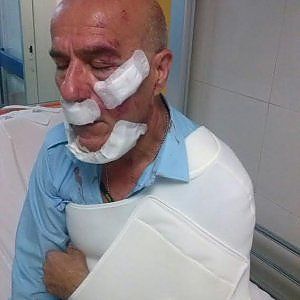 "Spostate le auto" e l'autista di Roma-Tpl viene aggredito dal branco 