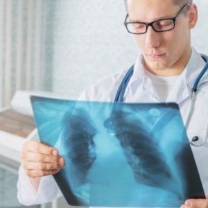 Il polmone sotto attacco, il cancro si può abbattere con l'immunoterapia