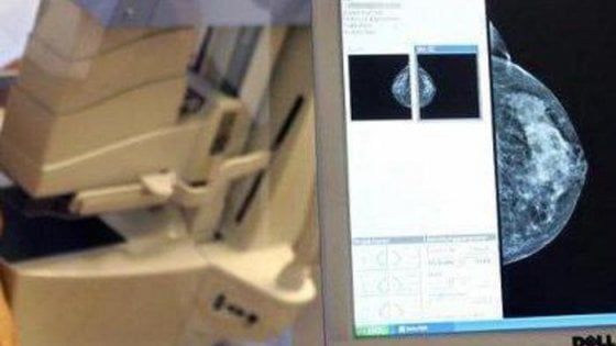 Cancro al seno, un algoritmo calcola il rischio di metastasi e recidive