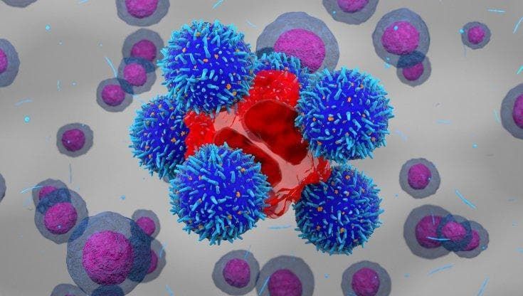 Mieloma multiplo, si amplia la possibilità di accedere alla terapia Car-T