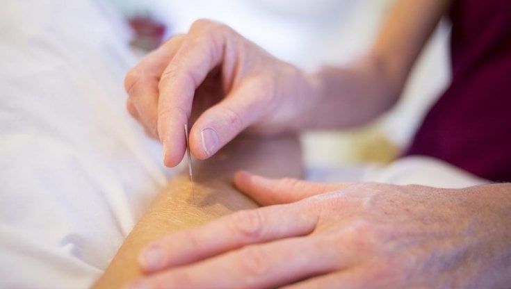 Adesso l'agopuntura entra anche in ospedale
