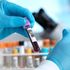 Un test del sangue potrebbe prevedere l’Alzheimer con dieci anni di anticipo