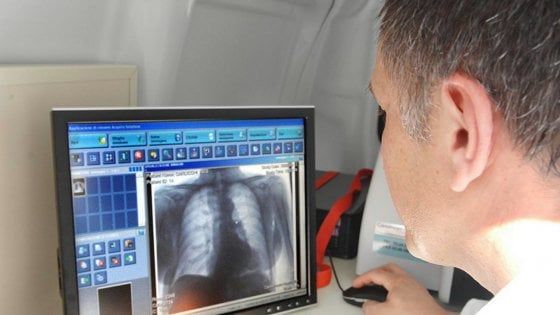 Coronavirus, il 30% dei guariti avrà problemi respiratori cronici