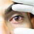 Glaucoma, un paziente su due non sa di averlo: diagnosi e terapie