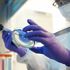 Coronavirus, studio dell'università di Brescia: su 100 pazienti curati con il farmaco antiartrite Tocilizumab il 77% è migliorato