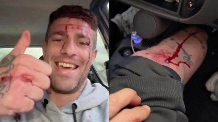 Tiktoker gambizzato a Fonte Nuova pubblica il video dopo l’agguato:“Hai sparato e m’hai lisciato”