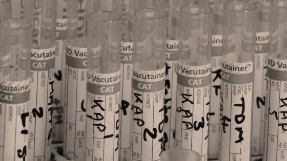 E la ricerca diventa di precisione