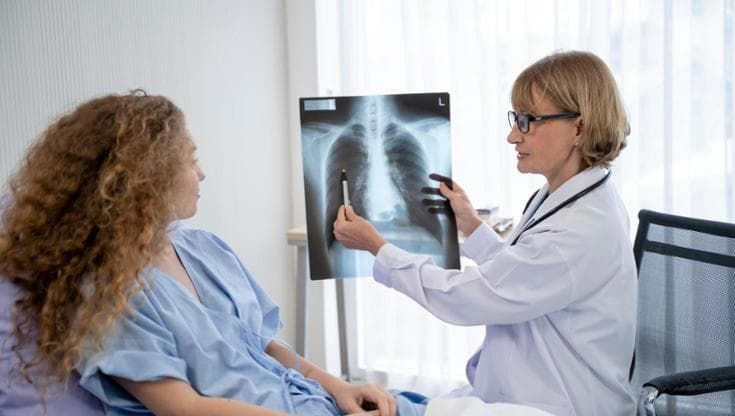Tumore del polmone, nuove prospettive per la terapia target