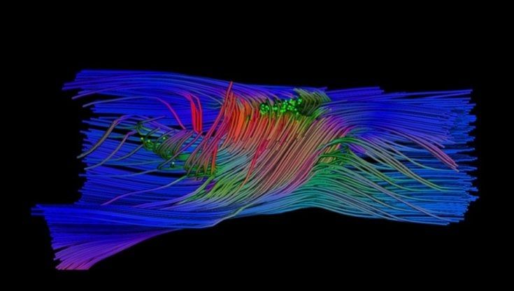 Non è più un tabu, il midollo spinale si può riparare