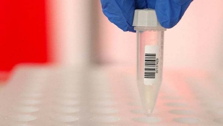 Covid, la saliva può predire se ci si ammalerà gravemente