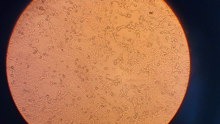 I laboratori del Sacco a Milano hanno isolato il virus del vaiolo delle scimmie