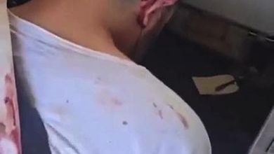 Flydubai, l'attentatore in ginocchio con i polsi legati e la camicia sporca di sangue