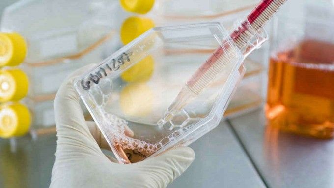 Nelle staminali cardiache il segreto per ripresa dopo infarto