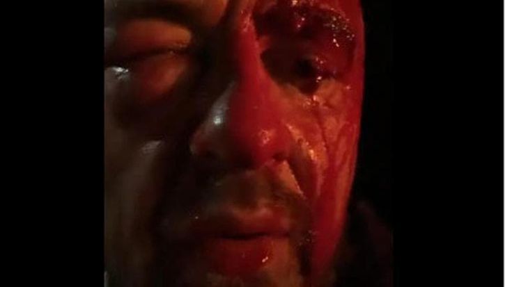 Aggressione a Chef Rubio, indaga la Digos. Solidarietà e critiche. Pacifici:”Dovrà rispondere per gli attacchi alla comunità ebraica”