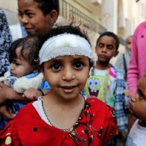 Yemen, almeno 10 bambini uccisi e tre feriti mentre tornavano da scuola