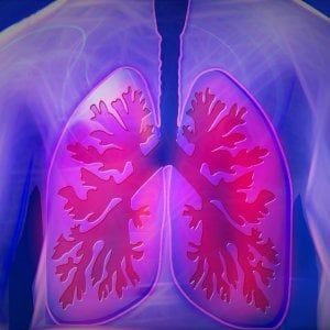 Tumore del polmone, l’immunoterapia ha un’arma in più 