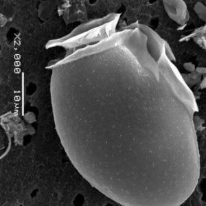 Oceani, in aumento le alghe tossiche a causa del riscaldamento globale