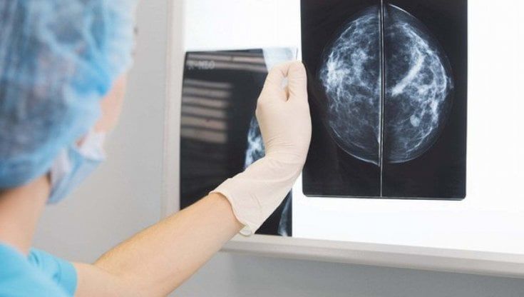 Tumore al seno: come scoprirlo in anticipo