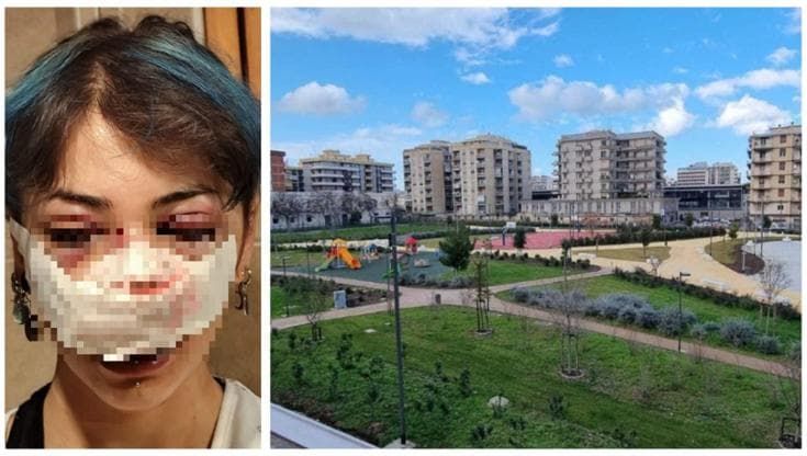 Giuditta d’Elia pestata nel parco, indagati l’addetta ai bagni e il compagno per lesioni e rapina