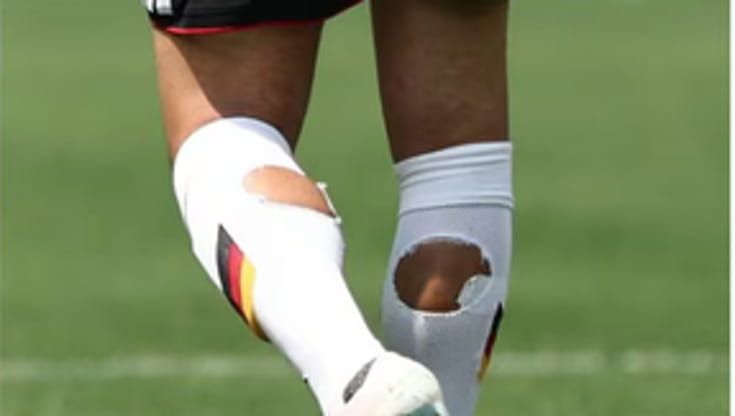I calzini col buco dopo gli scarpini rosa: perché spopolano al Mondiale
