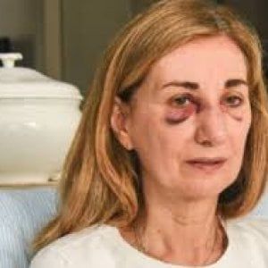 Mamma spaccò il setto nasale alla prof, bocciato il ragazzino