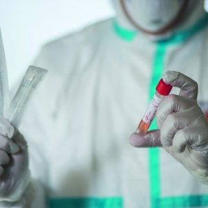 Coronavirus, ispezione dei Nas nel laboratorio di Soccavo