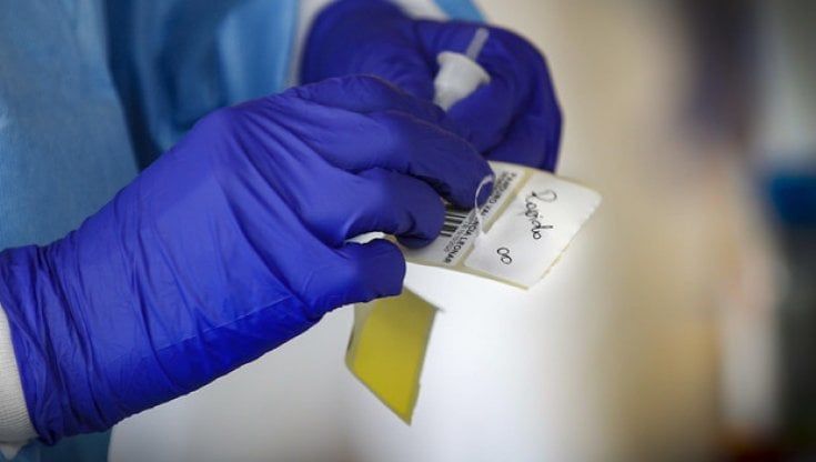 Covid, ecco perché i test antigenici non sono affidabili