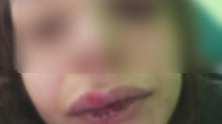 Disabile 23enne denuncia l’ex datore di lavoro: “Mi ha pestata perché chiedevo lo stipendio. Mi ha presa a calci, pugni e insulti”