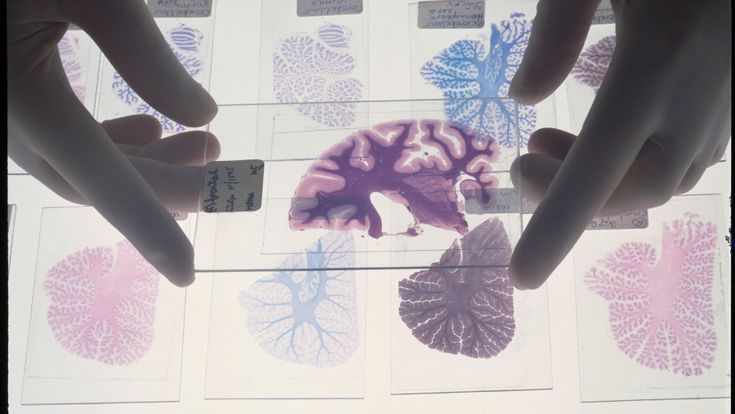 “Dai castelli di sabbia il segreto per costruire un cervello artificiale chimico”