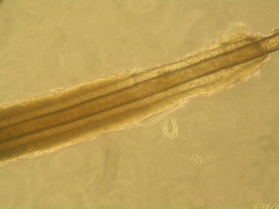 Capelli nati in laboratorio, verso soluzione della calvizie