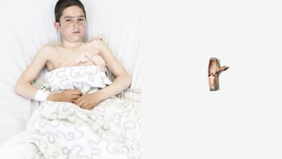 Buon compleanno Emergency: una mostra per 25 anni al fianco delle vittime di guerra