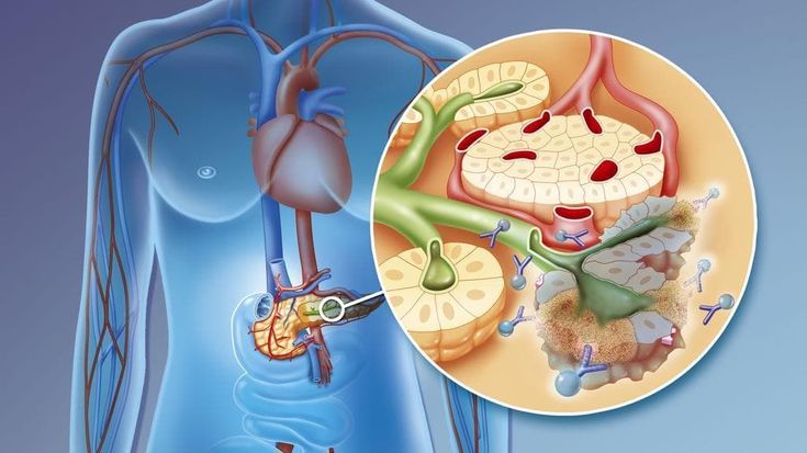 Sos per i farmaci immunoterapici “Sono sempre più cari e non sempre funzionano”