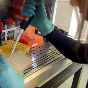 Terapie per diabete e tumori, Biovelocita lancia le prime startup biotech