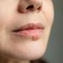 Perché è difficile sviluppare un vaccino efficace e sicuro contro l’Herpes simplex?