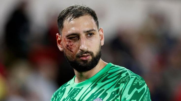 Donnarumma, trauma facciale e ferite multiple dopo lo scontro con Singo. Ai tifosi: “Tutto bene”