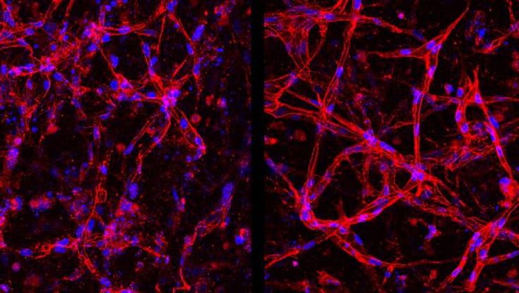 Retina, così le staminali possono riparare i vasi sanguigni