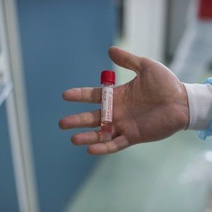 Coronavirus, l'affare kit veloci con prezzo variabile