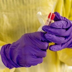 Coronavirus, l'Università del Piemonte orientale in campo con 50 progetti: "Dalle biobanche alle diagnosi, uniti contro il virus"