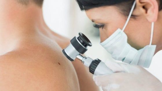 Tumori della pelle: raddoppiati in vent’anni soprattutto negli anziani 