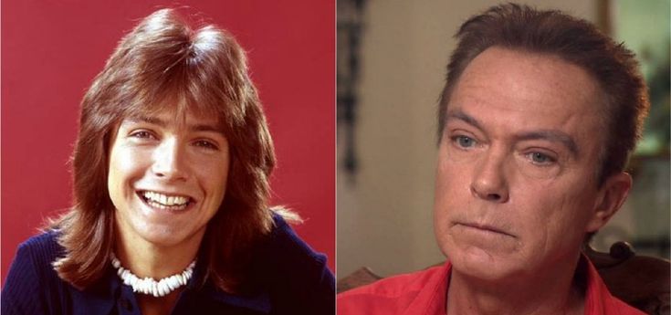 David Cassidy ricoverato in ospedale